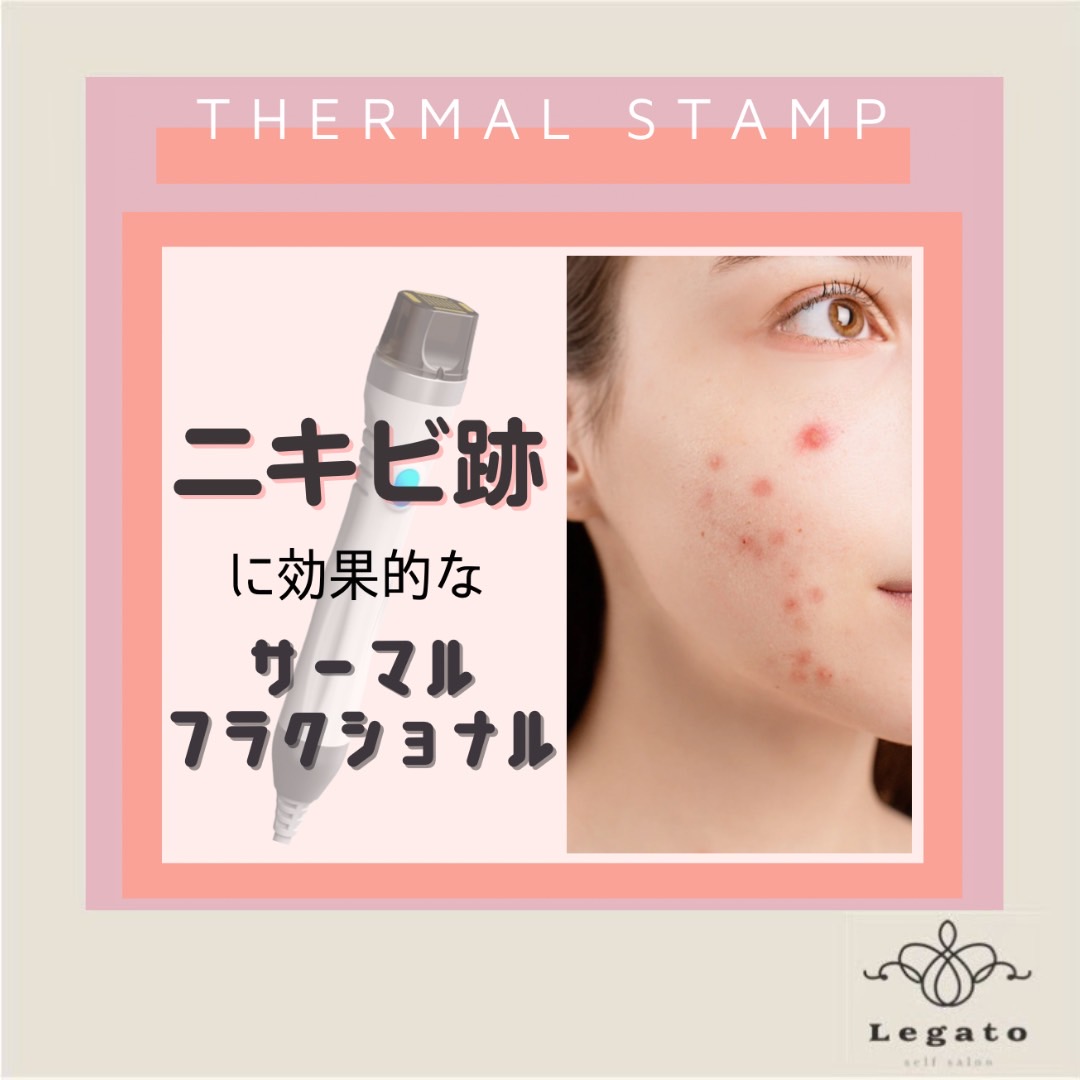 サーマクール　フラクショナル サーマルフラクショナル サーマクール サーマルフラクショナル