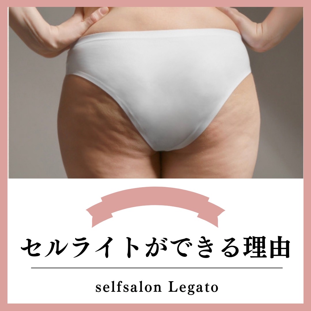 セルライトが出来る理由 - 松戸 セルフエステ Legato〈リガート